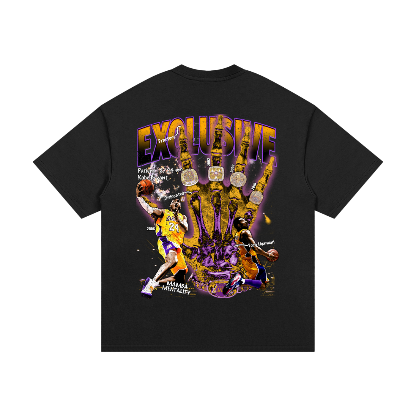 Kobe Bryant Hand X-ray